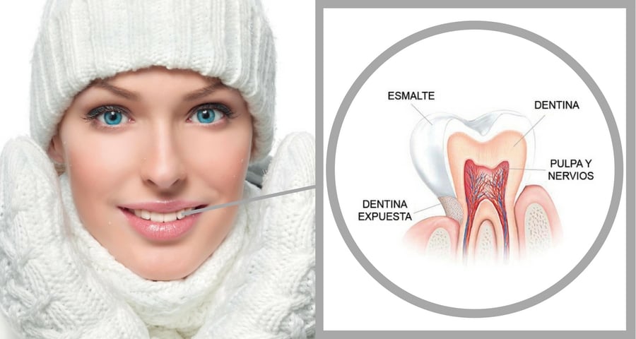 Sensibilidad dental