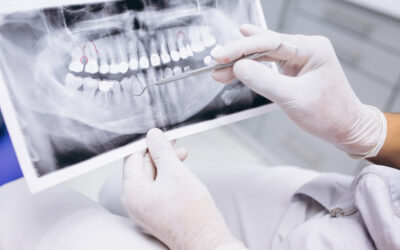 La radiología en odontología