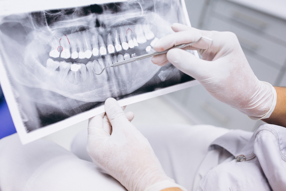 La radiología en odontología