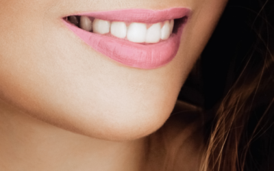 Falsos Mitos sobre el Blanqueamiento Dental