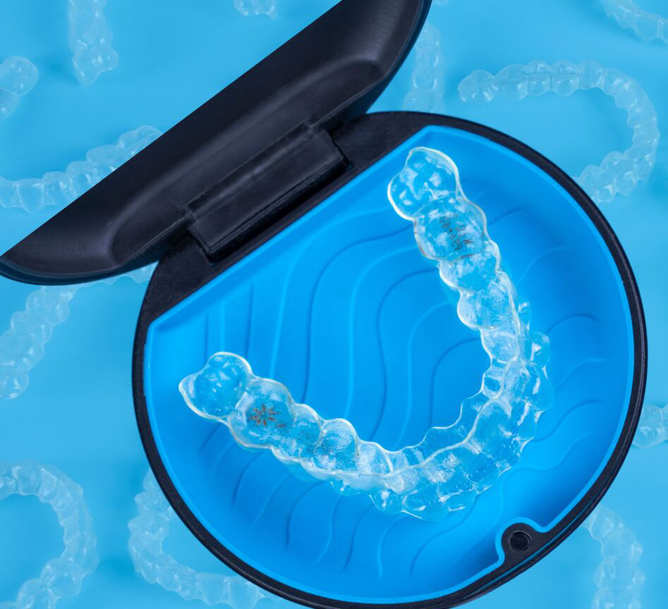 egala - 1 Implantes dentales